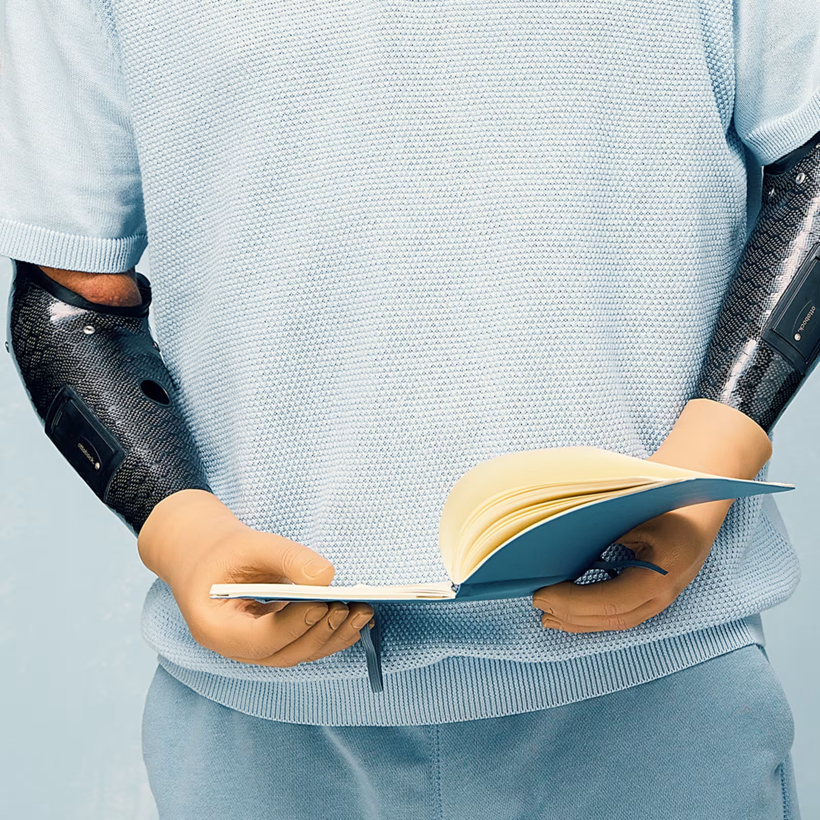 Body-Powered Prostheses