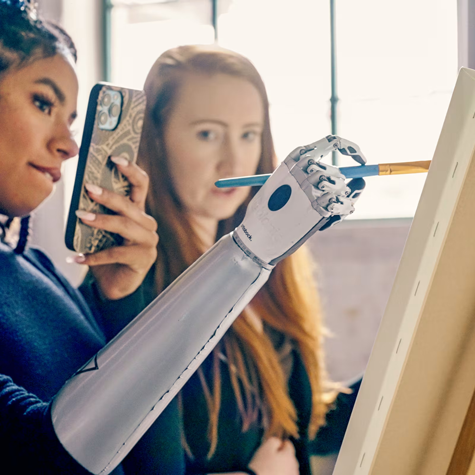 Upper Limb Prosthetics — Hands & Arms