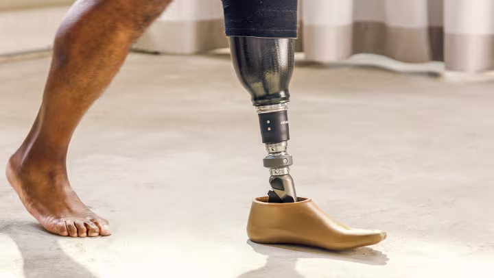 Lower Limb Prosthetics — Legs & Feet